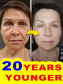 20 years younger, no fine lines